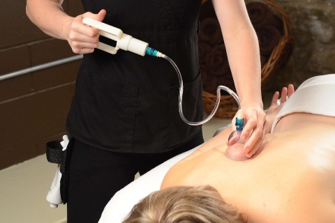cupping